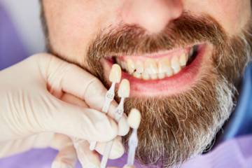 teeth-discoloration- صورة المقال